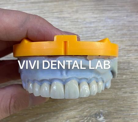 A estratificação de Ivoclar Emax folheia o laboratório dental de nível elevado profissional translúcido de China