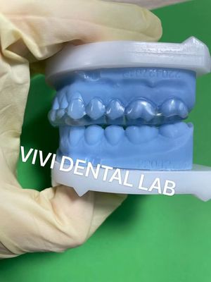 Tala dental Michigan estável com ajuste perfeito e qualidade profissional