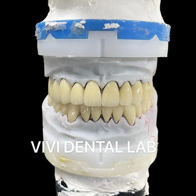 CHINA VIVI DENTAI LABORATORY Certificações