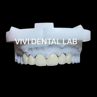 Coroa e ponte de zircônia dentária translúcida 3D PRO