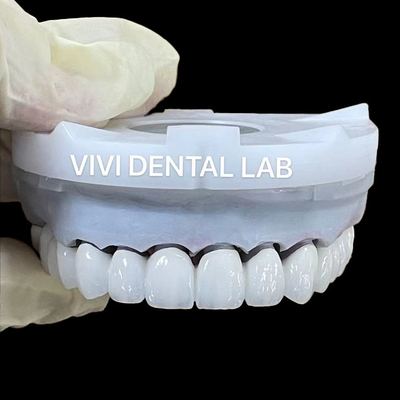 Coroas de laboratório dentário de zircônio super branco 3D PRO PFZ Noritake porcelana