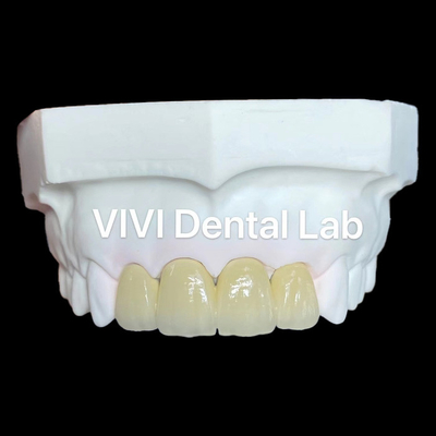 Coroas de zircônio PFZ Coroa de zircônio de porcelana Coroa dentária