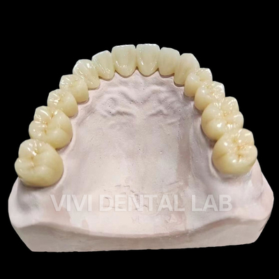 Dentista Full Bridge Total Bridge Profissional Complete Bridge