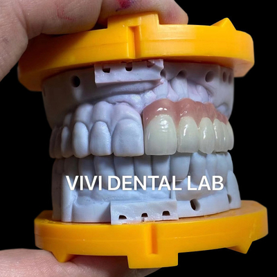 CHINA VIVI DENTAI LABORATORY Certificações