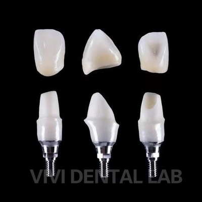 Implante Dental Tibase Zirconia Abutment Titânio Precisão personalizada