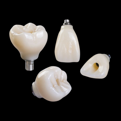 Implante dentário profissional de zircônio coroa de titânio CAD CAM