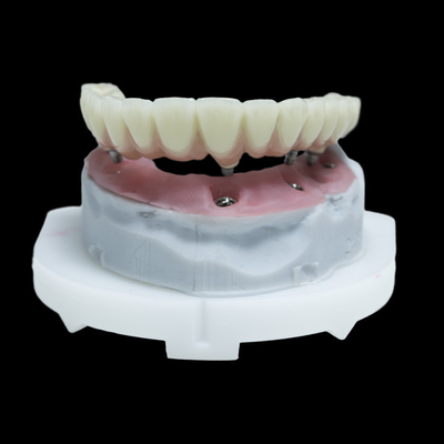 Todos em 4 PFM Implantes Dentários Coroa de Titânio Zircônio Todos em 6 Restaurações