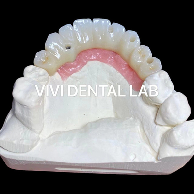 PMMA Precisão Full Zirconia Bridge Over Multi Unit Abutments