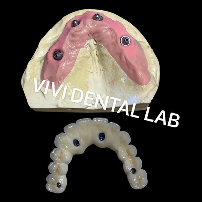 Todos enrolados em quatro ponte de zircônio Ivoclar Dental alta precisão