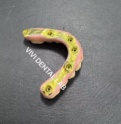 Ponte de zircônio com barra de titânio