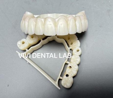 Ponte total de zircônia aparafusada Laboratório dentário chinês