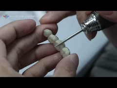 Ponte de metal cerâmica