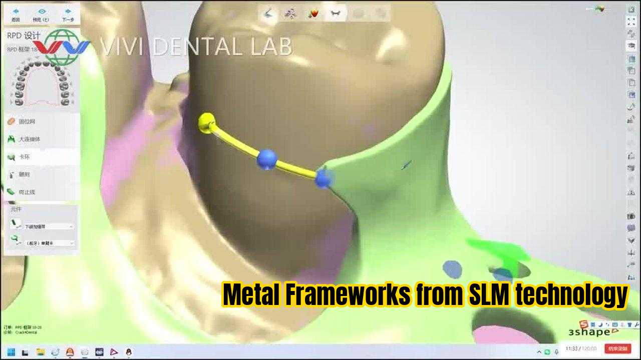 CHINA VIVI DENTAI LABORATORY Certificações